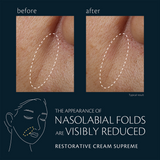 Restorative Cream Supreme (Refill),
