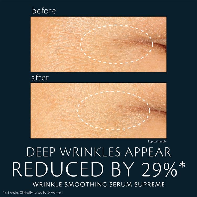 A side-by-side comparison shows the skin around an eye before and after using a wrinkle smoothing serum. The "after" image shows visibly reduced wrinkles in the highlighted area. Text below states, "Deep wrinkles appear reduced by 29%*," and "Wrinkle Smoothing Serum Supreme," with fine print noting “*In 2 weeks. Clinically tested by 34 women.”