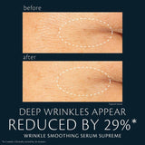 A side-by-side comparison shows the skin around an eye before and after using a wrinkle smoothing serum. The "after" image shows visibly reduced wrinkles in the highlighted area. Text below states, "Deep wrinkles appear reduced by 29%*," and "Wrinkle Smoothing Serum Supreme," with fine print noting “*In 2 weeks. Clinically tested by 34 women.”