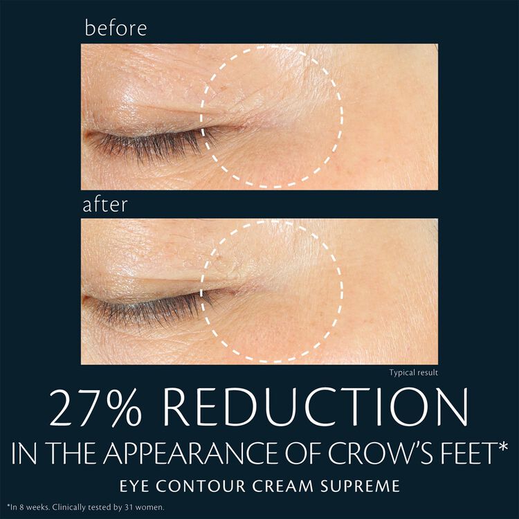 Before-and-after images of the eye area showing reduced appearance of crow’s feet after using Eye Contour Cream Supreme. Text below reads: "27% REDUCTION IN THE APPEARANCE OF CROW'S FEET" with a footnote "*In 8 weeks. Clinically tested by 31 women." and "Typical result".