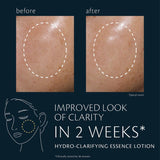 Hydro-Clarifying Essence Lotion,