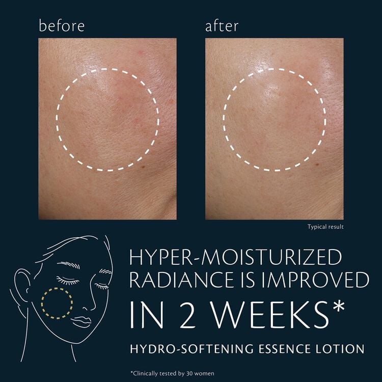 Hydro-Softening Essence Lotion,
