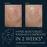 Hydro-Softening Essence Lotion,